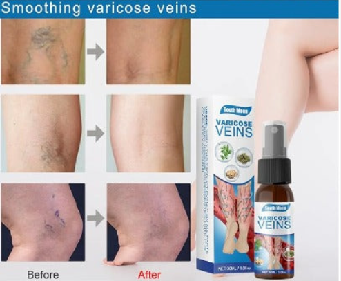 Spray para Varices